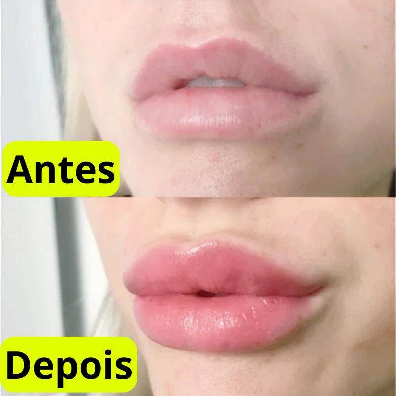 Hidra Lips  - Sérum labial com vitamina E